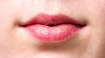 Wrinkles Above the Lips: The Best Treatments & Prevention